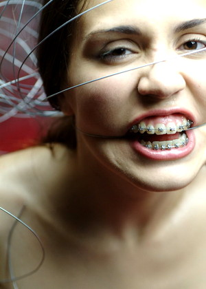 Beautyandbraces Model jpg 9