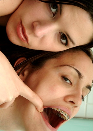 Beautyandbraces Model jpg 10