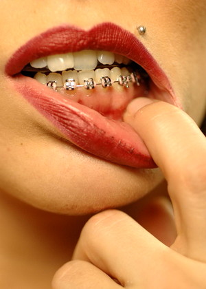 Beautyandbraces Model jpg 11