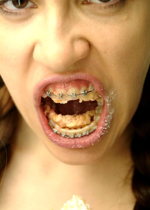 Beautyandbraces Model jpg 6