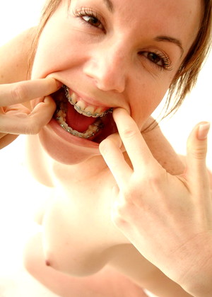 Beautyandbraces Model jpg 2